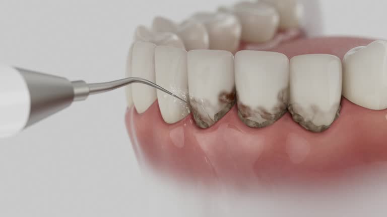 Reliable Dental Implants contractor in Corinth, MS by Smile Center Dentistry